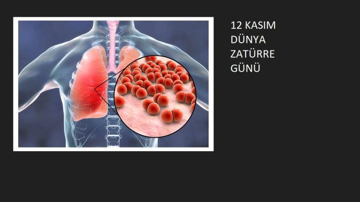 ZATÜRRE GÜNÜ 12 KASIM